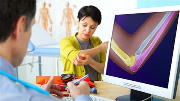 Người phụ nữ gãy 3 xương sườn sau trận ho, thủ phạm là đồ uống mà rất nhiều người thích-4