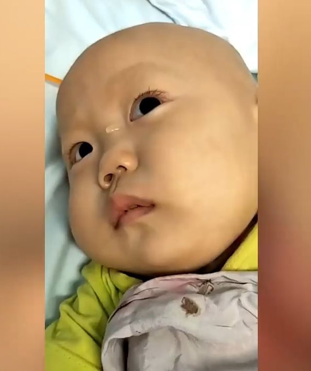 Cuộc đời bi kịch của cậu bé 2 tuổi nổi tiếng mạng xã hội khiến nhiều người rơi nước mắt-2