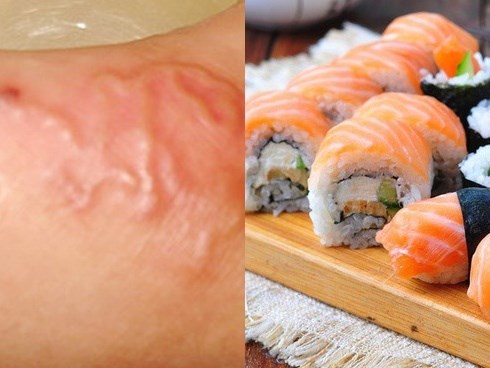 Top món ăn khoái khẩu nhưng khiến người ăn sẽ gặp nguy cơ nhiễm sán cực cao