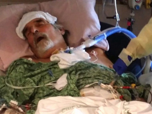 Nhiễm vi khuẩn ăn thịt người khi cất dọn đồ trang trí giáng sinh, bà mẹ 2 con suýt mất mạng-5