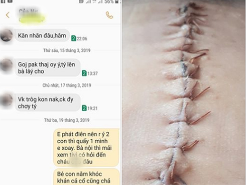 Bí mật động trời thuở 18 của vợ trẻ bất ngờ phơi bày khiến chồng chết sững-2