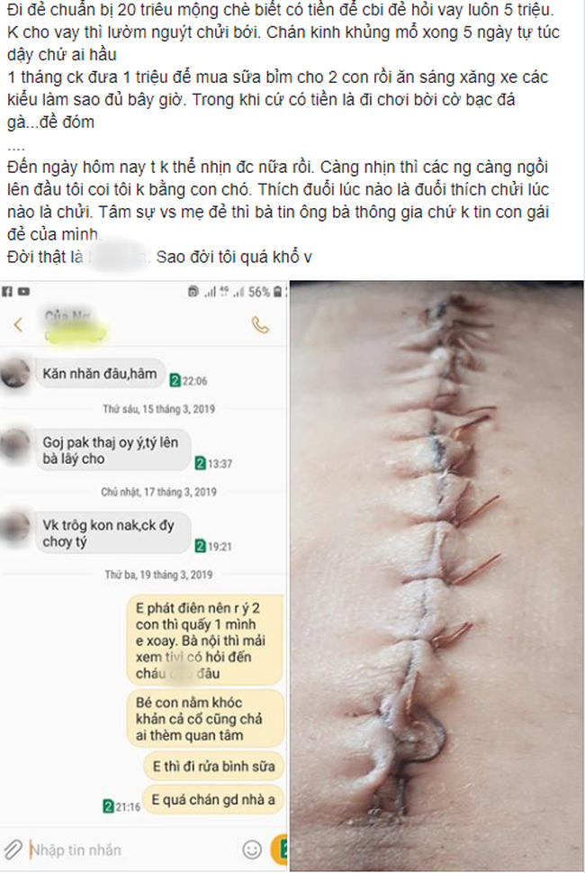 Tâm sự của nàng dâu sinh mổ chẳng được kiêng cữ, mẹ chồng bòn rút tiền đẻ, chồng ham chơi để mình vợ chăm con làm chị em rơi lệ-1