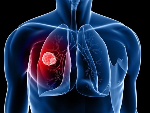 Loại quả cả thế giới đều dùng nhưng không biết nó là khắc tinh ung thư phổi-2