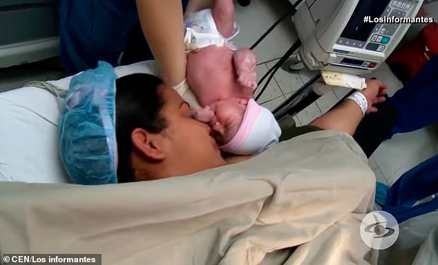 Đỡ đẻ cho một sản phụ xong, bác sĩ chết điếng người khi nhìn thấy một thai nhi khác đã hình thành tay chân trong bụng bé gái mới sinh-5