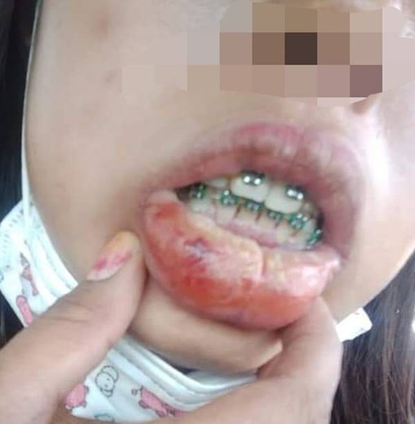 Niềng răng để mong được lột xác, cô gái trẻ nào ngờ phải nhận về cái kết đắng ngắt-2