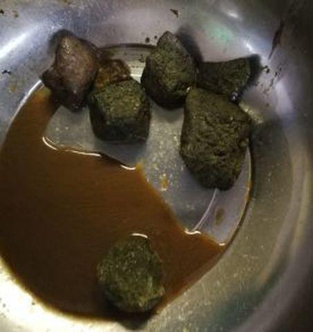 Dạ dày có 10 viên sỏi to như trứng vì thường xuyên ăn loại quả nhiều người thích-1