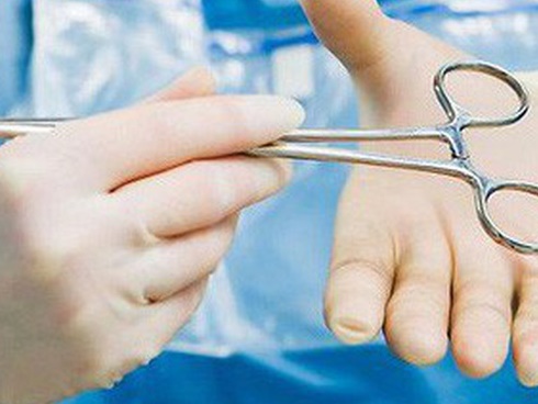 Những người không dễ bị ung thư đều có 4 điểm chung: Hãy xem bạn có thuộc nhóm này không?-6