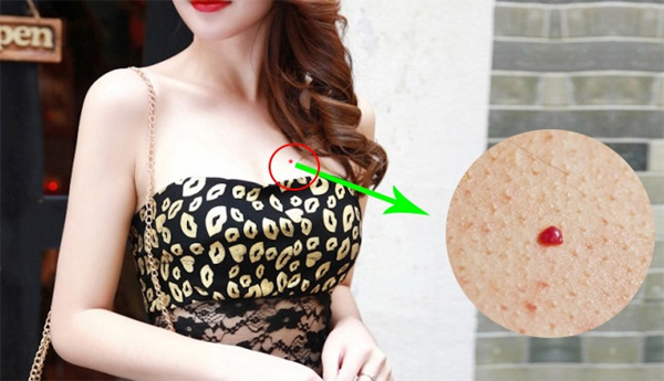 Thầy tử vi tiết lộ: Ai có nốt ruồi son ở chỗ HIỂM này cực tốt số, chưa 40 đã giàu kếch xù-1