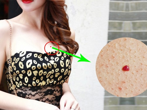Đàn bà có 4 kiểu nốt ruồi ở ngực này vận khí cực tốt, TRỜI ĐỊNH CÓ SỐ GIÀU SANG, chồng chiều hết mực-4