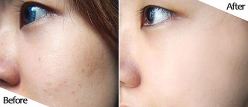 Mỗi sáng ăn 1 thìa nha đam da cứ thế căng bóng, trắng hồng như gái 18-8