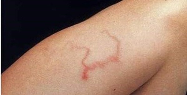 Ớn lạnh những ca nhiễm ký sinh trùng có một không hai”-4