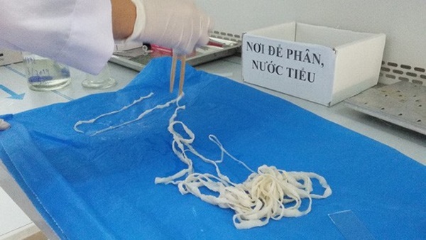 Ớn lạnh những ca nhiễm ký sinh trùng có một không hai”-5