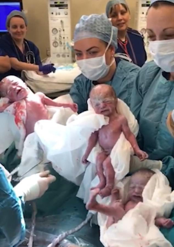 Dù đã được báo trước nhưng bà mẹ vẫn không thể tin vào mắt mình khi bác sĩ đón một đàn con trong bụng cô chào đời-2