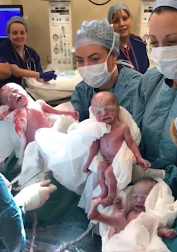 Dù đã được báo trước nhưng bà mẹ vẫn không thể tin vào mắt mình khi bác sĩ đón một đàn con trong bụng cô chào đời-4