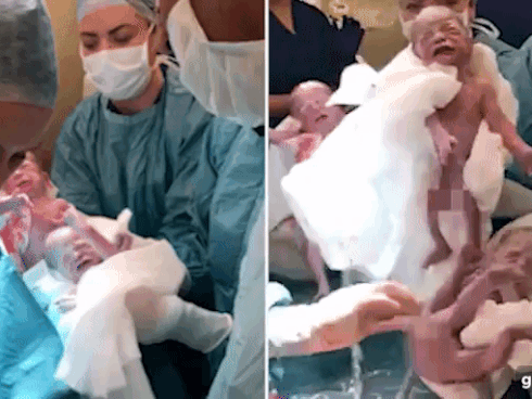 Dù đã được báo trước nhưng bà mẹ vẫn không thể tin vào mắt mình khi bác sĩ đón "một đàn con" trong bụng cô chào đời Dù đã được báo trước nhưng bà mẹ vẫn không thể tin vào mắt mình khi bác sĩ đón "một đàn con" trong bụng cô chào đời