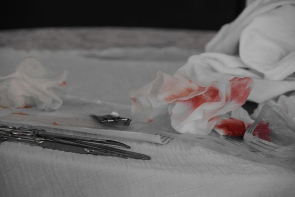 Bố mẹ tự tay cắt bao quy đầu tại nhà, con trai 5 tháng tử vong-2