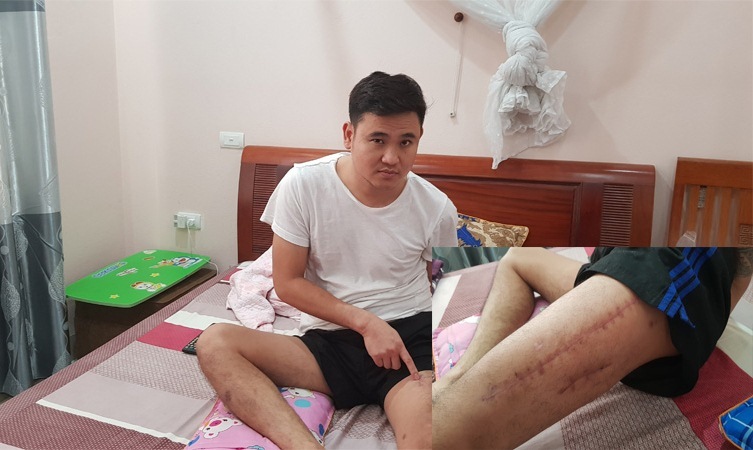 Cảnh sát 113 Thanh Hóa bắn thanh niên nát xương đùi vì nghi ngáo đá-2