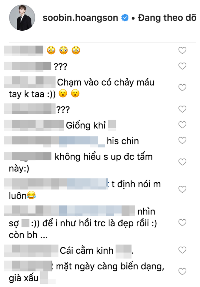 Sao Vbiz và những lần lộ diện với gương mặt lạ lẫm: Cằm nhọn hoắt, mũi sưng phồng khiến fan tá hoả-6