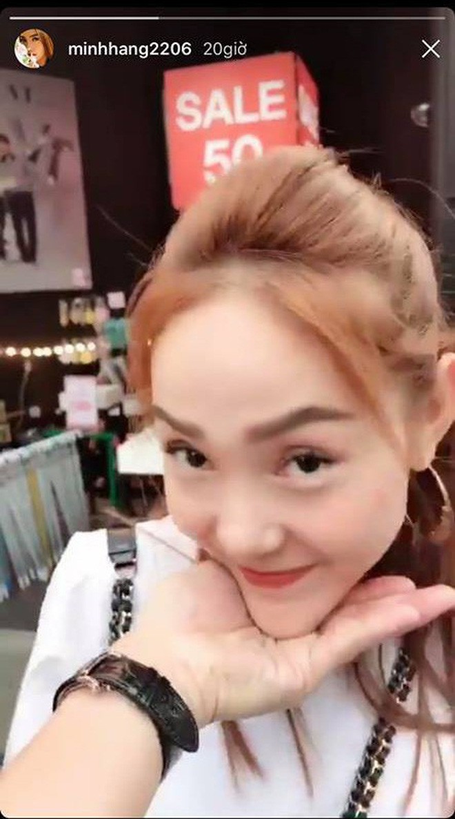 Sao Vbiz và những lần lộ diện với gương mặt lạ lẫm: Cằm nhọn hoắt, mũi sưng phồng khiến fan tá hoả-8