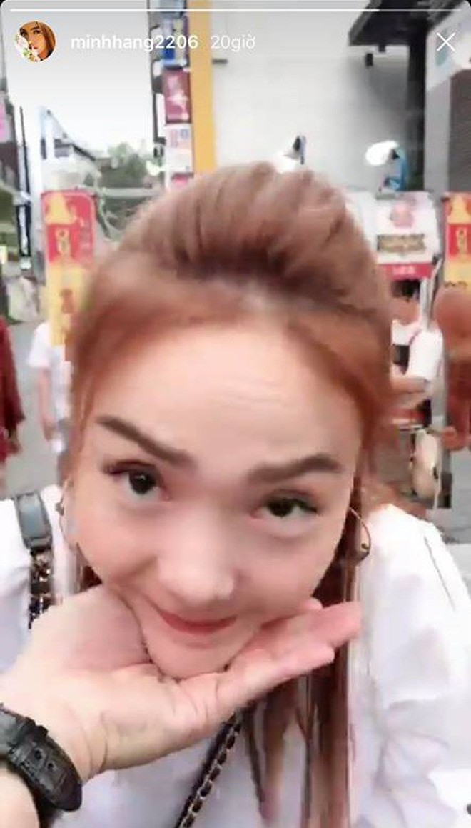 Sao Vbiz và những lần lộ diện với gương mặt lạ lẫm: Cằm nhọn hoắt, mũi sưng phồng khiến fan tá hoả-9