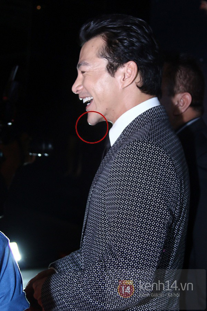 Sao Vbiz và những lần lộ diện với gương mặt lạ lẫm: Cằm nhọn hoắt, mũi sưng phồng khiến fan tá hoả-16