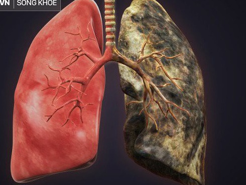 Dân gian ví von 1 chim câu tốt bằng 9 gà: Chuyên gia phân tích sẽ khiến bạn bất ngờ-4