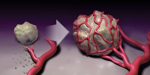 Những người không dễ bị ung thư đều có 4 điểm chung: Hãy xem bạn có thuộc nhóm này không?-4