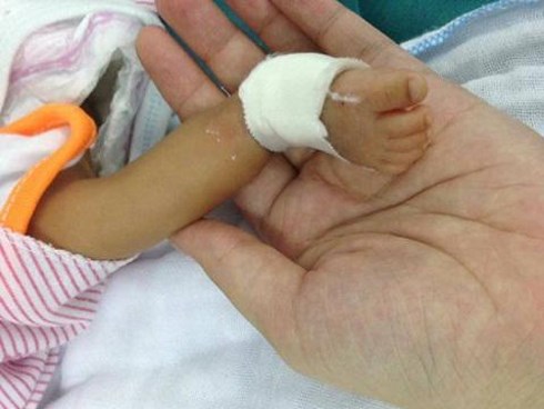 Bé trai sinh non ở xóm trọ Hà Nội, đưa vào viện tử vong nhưng chưa tìm thấy mẹ
