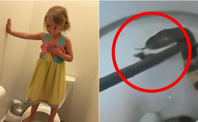 Nhấc con gái 5 tuổi đang ngồi trên bồn cầu trong nhà vệ sinh công cộng, bà mẹ la hét vì nhìn thấy thứ nguy hiểm chết người bên dưới-1