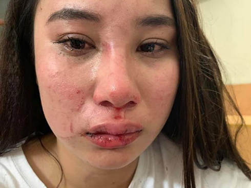 Vụ phản bội hot nhất MXH: Vợ đi mót rau nuôi chồng thuở hàn vi, có nhà lầu xe hơi thì chồng cặp bồ, đánh vợ đổ máu-6