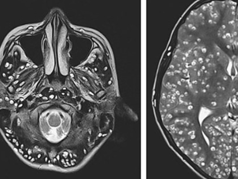 Điểm mặt 4 con quái vật trong cơ thể bạn-2