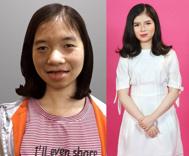 Gương mặt mới xinh đẹp của 9X Tiền Giang, Quảng Bình từng bị miệt thị vì xấu-4