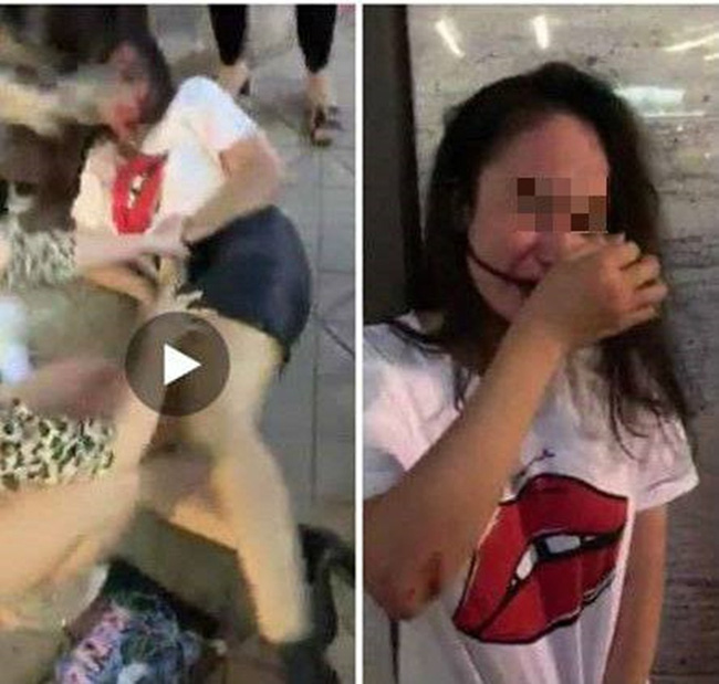 Vụ cô gái trẻ bị đánh, lột quần áo giữa phố: Nạn nhân hoảng loạn, đang điều trị tại bệnh viện-1