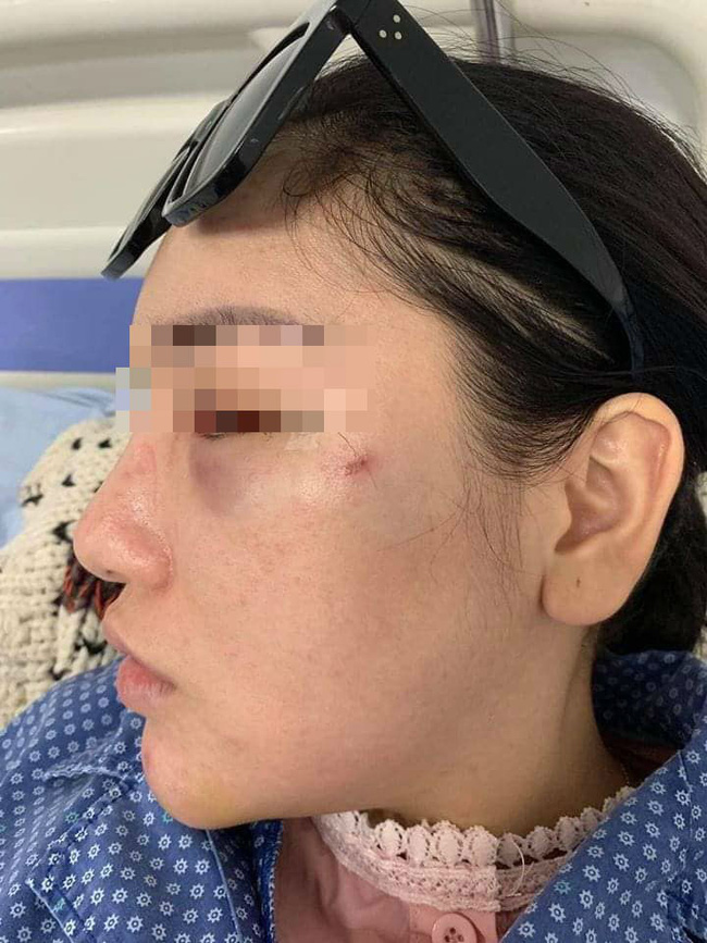 Vụ cô gái trẻ bị đánh, lột quần áo giữa phố: Nạn nhân hoảng loạn, đang điều trị tại bệnh viện-3