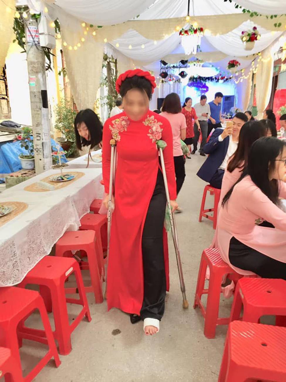 Cô dâu số nhọ bị ngã gãy chân ngay trước ngày cưới, dân tình xúm vào an ủi một câu mà ai cũng cười-4