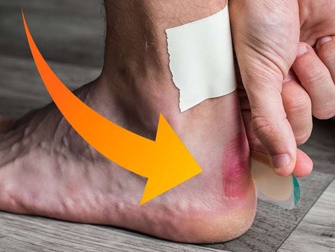 Thấy sốt về chiều và đau lưng nên đi khám ngay nếu không muốn bị bệnh khổ sở như người phụ nữ này-5