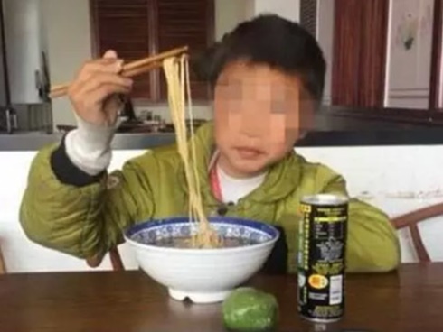 Ở mắt và chân tay có những dấu hiệu này, bạn nên đi kiểm tra xem thận có bị suy yếu không?-3