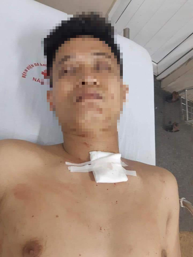 Nam thanh niên đâm cô gái trẻ hàng chục nhát rồi tự sát, nghi do mâu thuẫn yêu đương-2