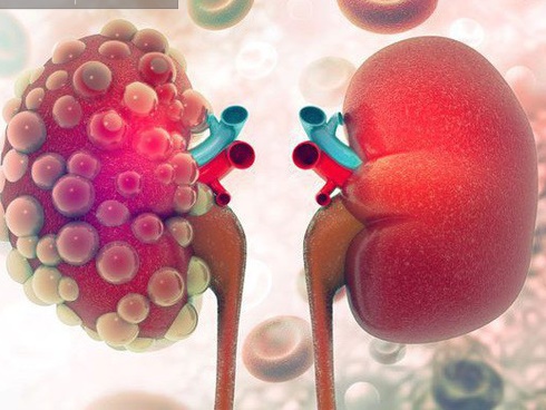 Thần dược giá bèo chống ung thư, chữa liệt dương, gan nhiễm mỡ-4