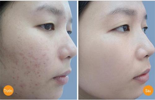 Uống bột nghệ pha với thứ này, da đen đến mấy cũng phải bật 2 tone-6