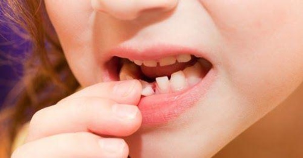 Đừng vội vứt răng sữa của con đi vì chúng có thể cứu mạng bé khi trưởng thành-2