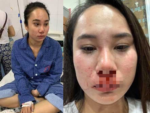 Quảng Ninh: Nghi vợ ngoại tình, chồng dùng dao đâm vợ nhiều nhát đến chết-1