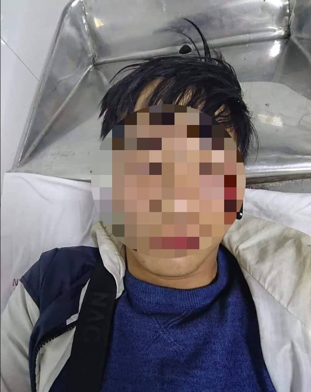 Giao hàng muộn, shipper bị khách phang điếu cày vào mặt-1