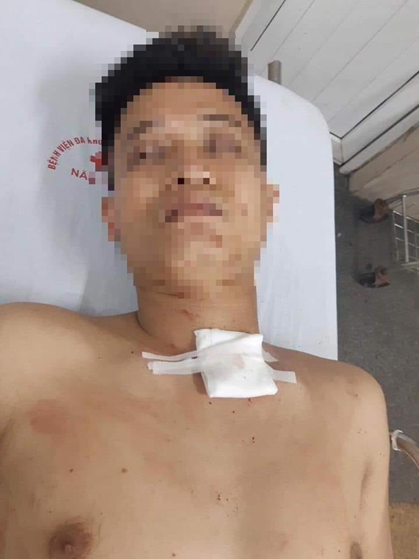 Nam thanh niên đâm cô gái hàng chục nhát ở Ninh Bình là tài xế Grab, chưa có tiền án tiền sự-2