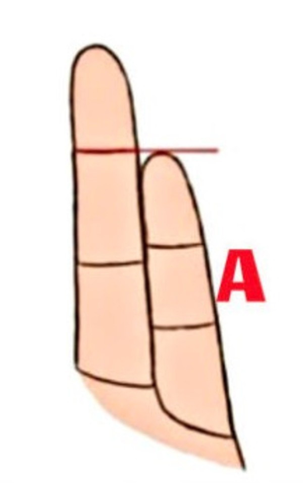 Ngó ngón út 3 giây: Thấy DẤU HIỆU VÀNG này xuất hiện thì xin chúc mừng, bạn sắp phát tài to-2