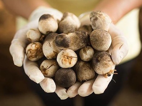 Cậu bé mới 5 tuổi đã bị gan nhiễm mỡ, thủ phạm chính là loại thực phẩm hầu hết trẻ em đều thích và thường ăn-4