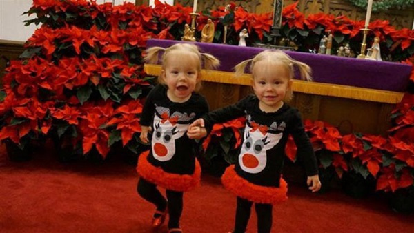 Sau 5 năm, 2 bé gái trong bức ảnh cặp song sinh nắm chặt tay nhau chào đời từng gây bão mạng xã hội giờ đã lớn khôn, có một điểm kỳ lạ khó giải thích nổi-10