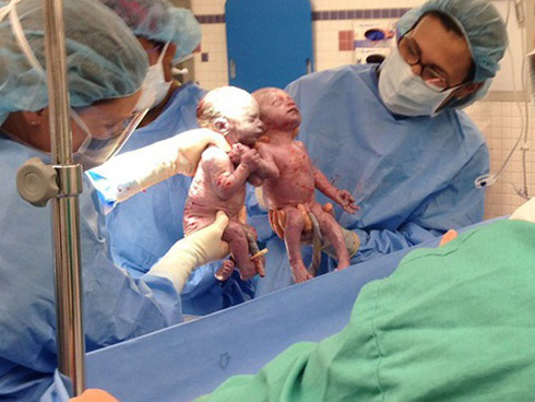 Từ trong bụng mẹ đã đánh nhau ầm ầm, cặp đôi song sinh chưa chào đời đã nổi tiếng khắp MXH-3