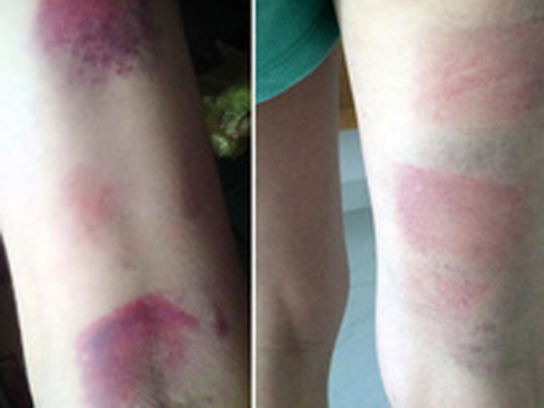 Học sinh lớp 5 ở Nghệ An dùng dao bấm đâm bạn-3