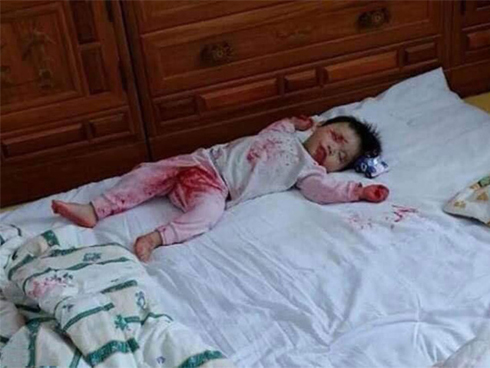 Chơi dại chui đầu qua song sắt, cô bé khiến người lớn phải dùng biện pháp mạnh để cứu-5